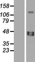 XRCC4 Protein (Over-Expression Lysate Myc-DDK (Flag))
