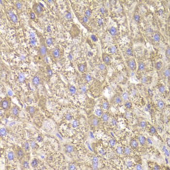 CIAPIN1 / Anamorsin Antibody