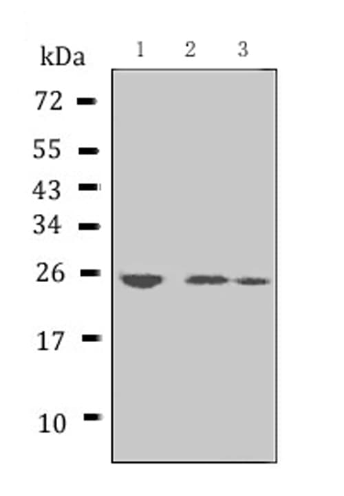 APCS / Serum Amyloid P / SAP Antibody (aa21-224)