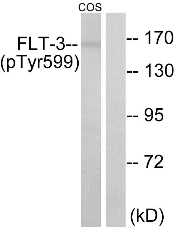 Polyclonal Rabbit anti-Human CD135 / FLT3 Antibody (phospho-Tyr599, WB)