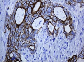 KRT5 / CK5 / Cytokeratin 5 Antibody (clone OTI4A7)
