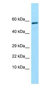 TREH Antibody (aa272-321)