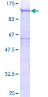 Human SDC4 / Syndecan 4 Protein (Recombinant GST)