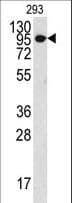 COL9A1 / Collagen IX Antibody (aa428-456)