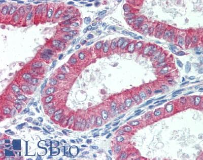 IHC-plus™ RTN3 / Reticulon 3 Antibody (clone 1E+11)
