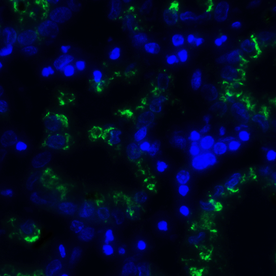 Monoclonal Mouse anti-Human TIGIT Antibody (clone 10B1, IHC, IF)