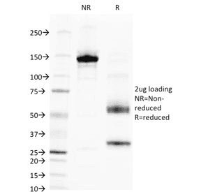 Monoclonal Mouse anti-Human ALPL / Alkaline Phosphatase Antibody (clone V17.1, Azide-free,BSA-free, IHC, IF)