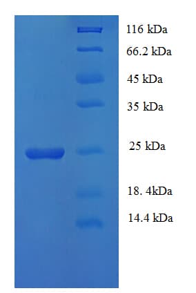 Human HLA-DQA1 Protein (Recombinant His)