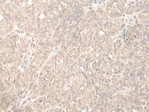 Polyclonal Rabbit anti-Human HENMT1 Antibody (IHC)