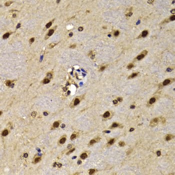Polyclonal Rabbit anti-Human HMG20A Antibody (IHC, IF, WB)