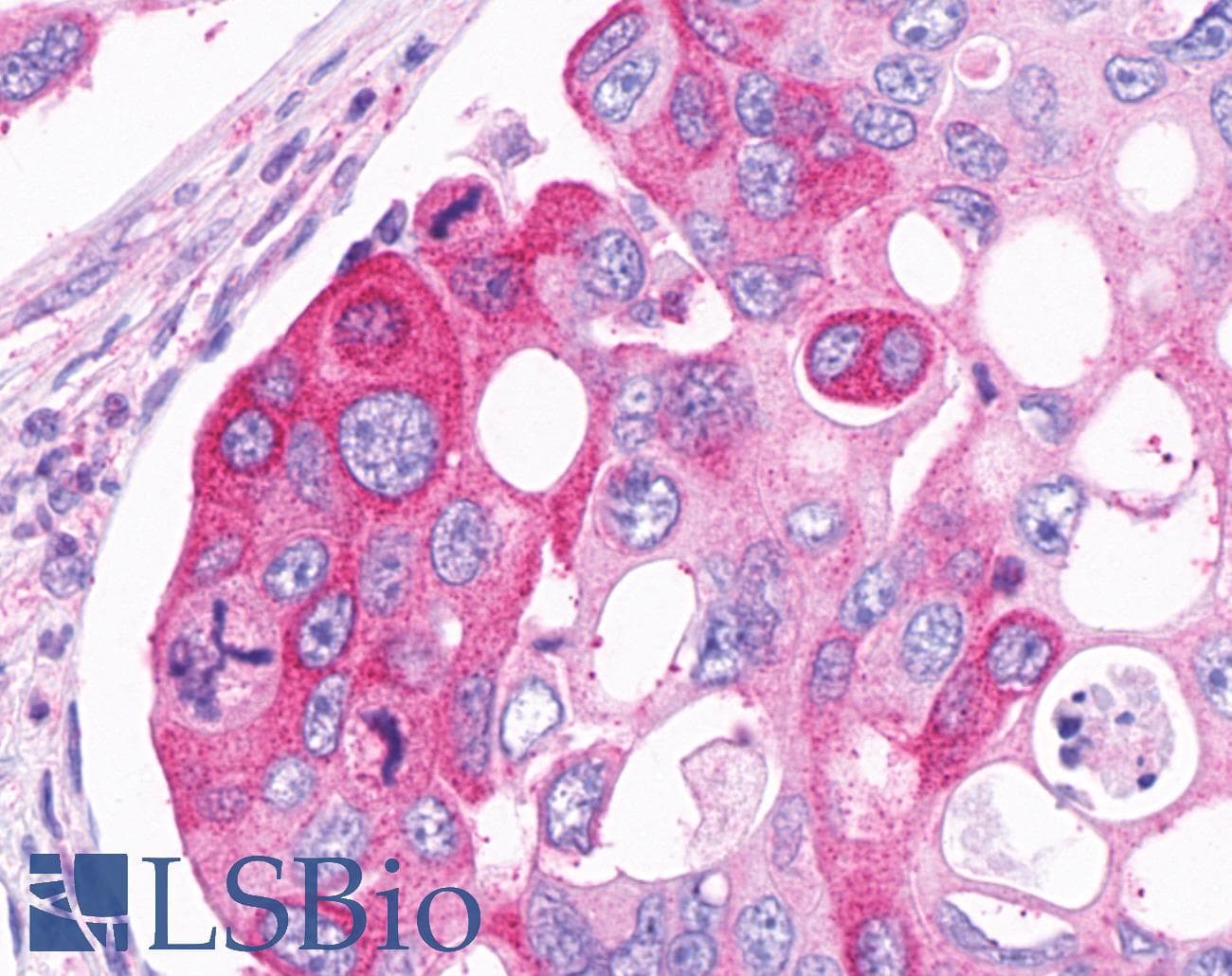 PathPlus™ LPAR2 / EDG4 Antibody (Cytoplasmic Domain)