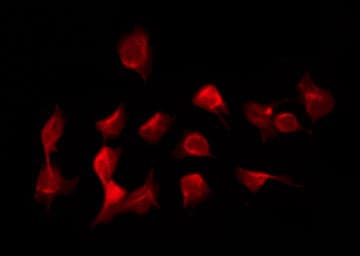 Polyclonal Rabbit anti-Human Epsin 1 / EPN1 Antibody (IF, WB)