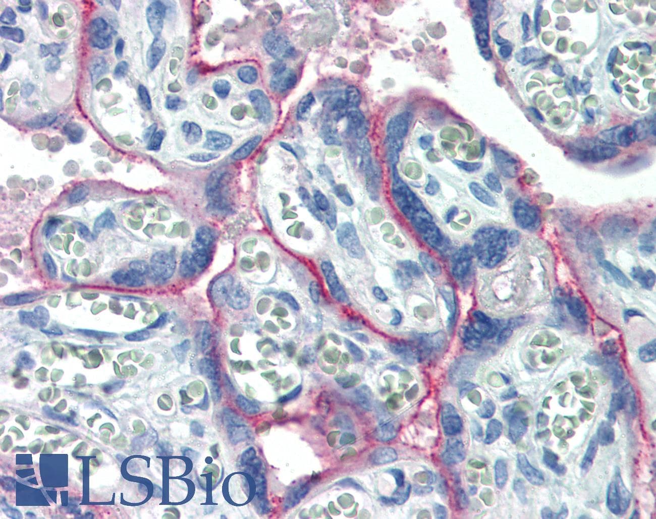 IHC-plus™ Polyclonal Rabbit anti-Human c-Met Antibody (C-Terminus, IHC)