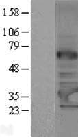 TRMT61A / TRM61 Protein (Over-Expression Lysate Myc-DDK (Flag))