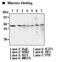 TXNIP Antibody (clone JY1)