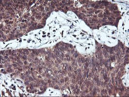 HDHD1 Antibody (clone OTI3E11)