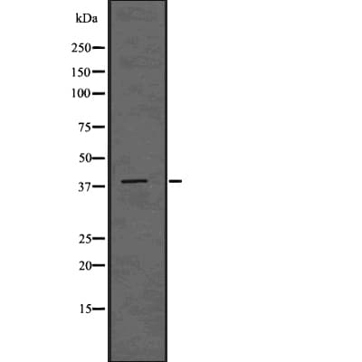 ADH6 Antibody