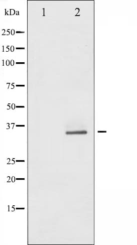 CDK5 Antibody
