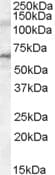 IRAK3 / IRAKM / IRAK-M Antibody (aa582-593)