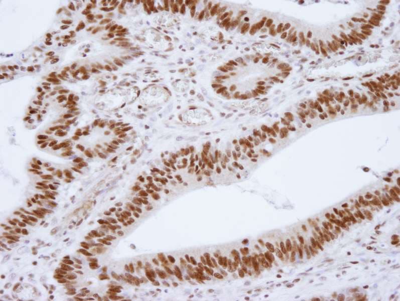 Polyclonal Rabbit anti-Human HDAC1 Antibody (aa425-C-term, IHC, IF)