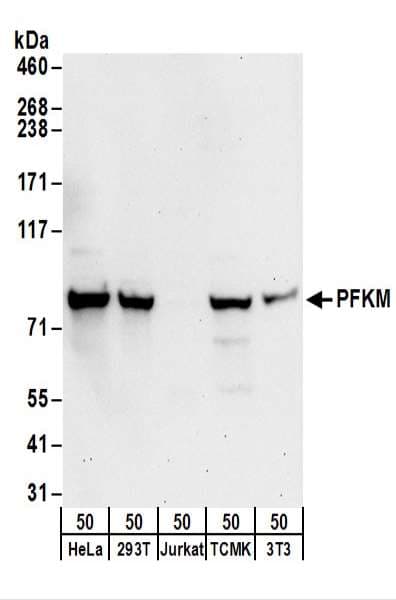 Polyclonal Rabbit anti-Human PFKM / PFK-1 Antibody (aa730-780, WB)