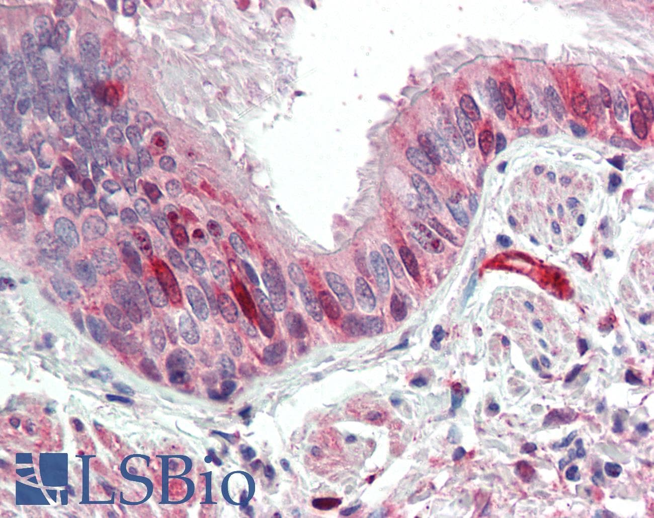 IHC-plus™ CNN3 Antibody (aa309-323)