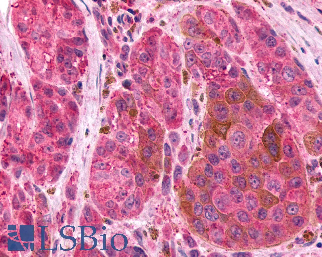 PathPlus™ Polyclonal Rabbit anti-Human ADGRE2 / EMR2 Antibody (N-Terminus, IHC)