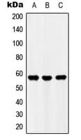 IHC-plus™ Polyclonal Rabbit anti-Human UBFD1 Antibody (C-Terminus, IHC, WB)