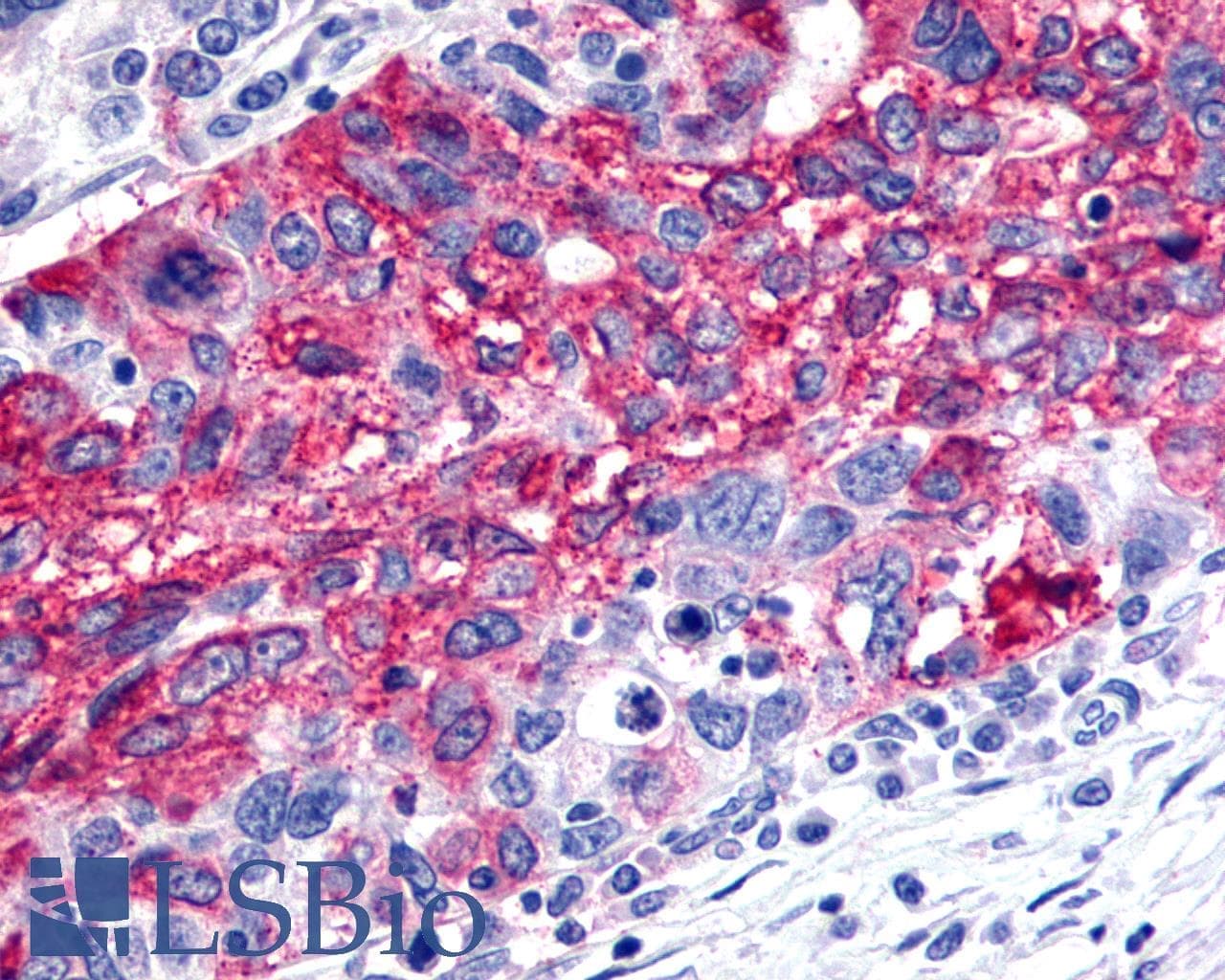 IHC-plus™ FZD2 / Frizzled 2 Antibody (Extracellular Domain)