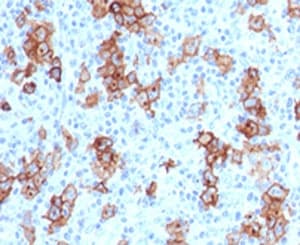 CD30 Antibody (clone CDLA30-1)