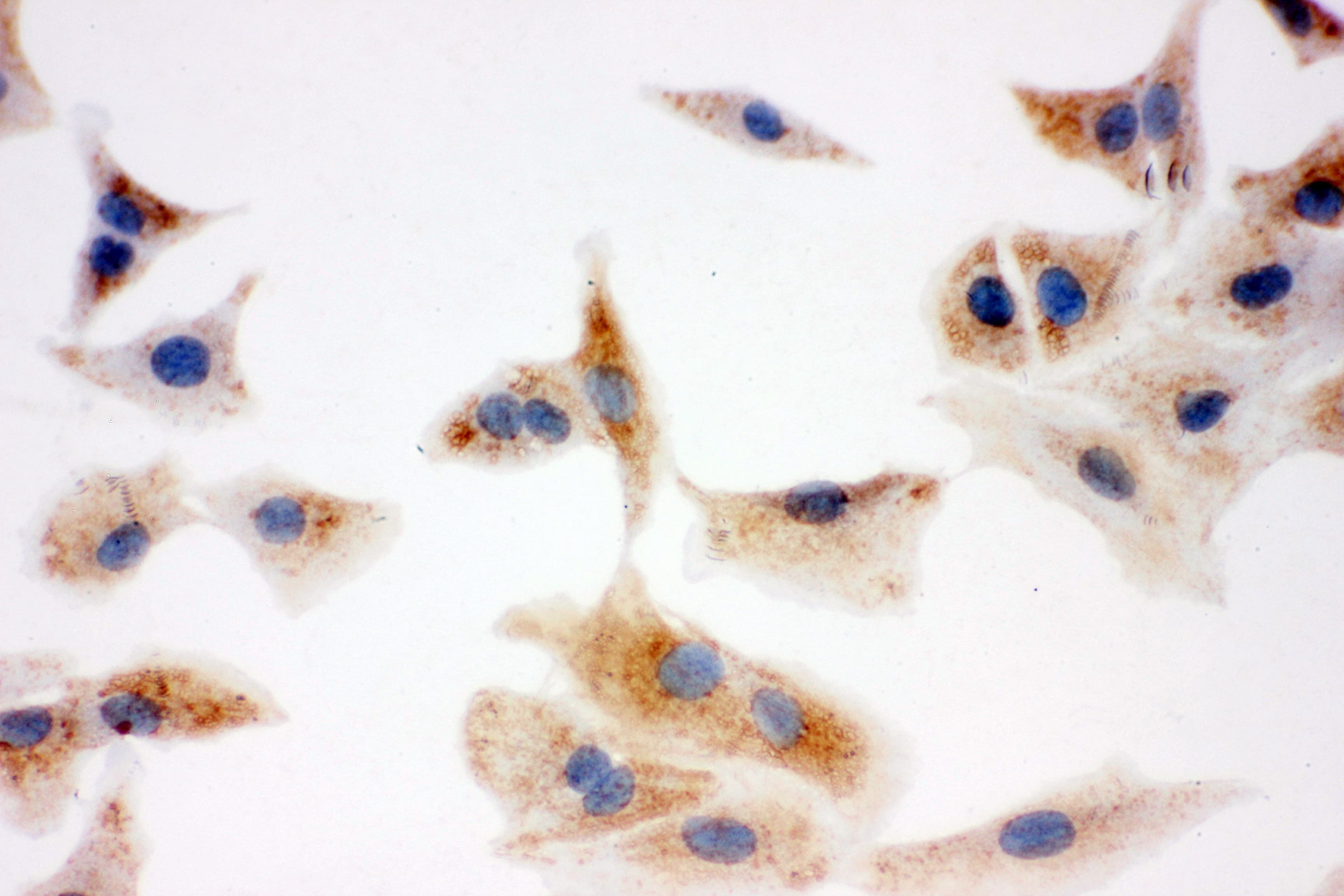 ECI1 / DCI Antibody (aa272-290)