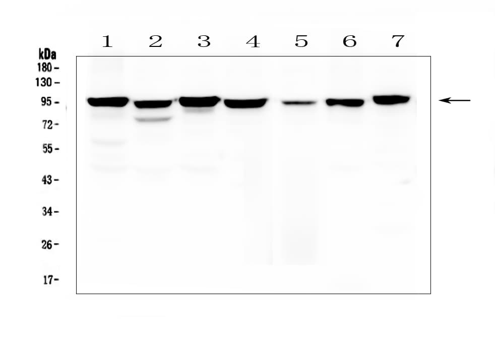 CTNNB1 / Beta Catenin Antibody