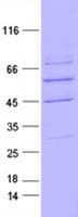 Human NTRK3 / TRKC Protein (Recombinant DDK,C-terminus)
