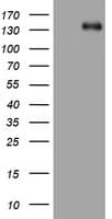 ZEB1 / AREB6 Antibody (aa1-350, clone OTI3G6)