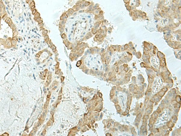 Polyclonal Rabbit anti-Human ETAA1 Antibody (IHC)