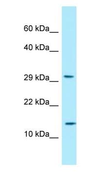 Polyclonal Rabbit anti-Human RPLP2 Antibody (N-Terminus, WB)