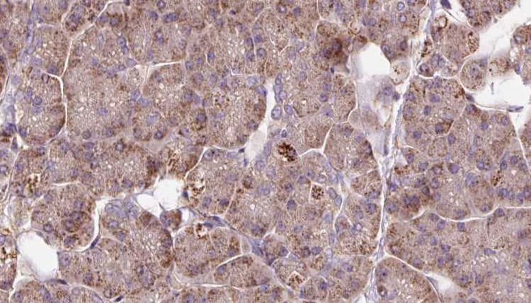 Polyclonal Rabbit anti-Human PAFAH2 Antibody (IHC, IF, WB)