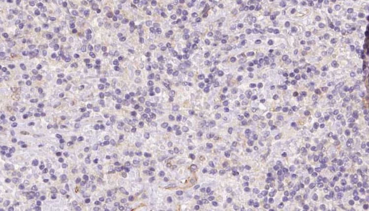 Polyclonal Rabbit anti-Human ASAH1 / Acid Ceramidase Antibody (IHC, WB)