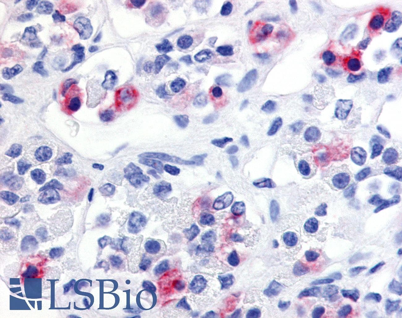 IHC-plus™ Polyclonal Rabbit anti-Human PRLHR / GPR10 Antibody (Extracellular Domain, IHC)