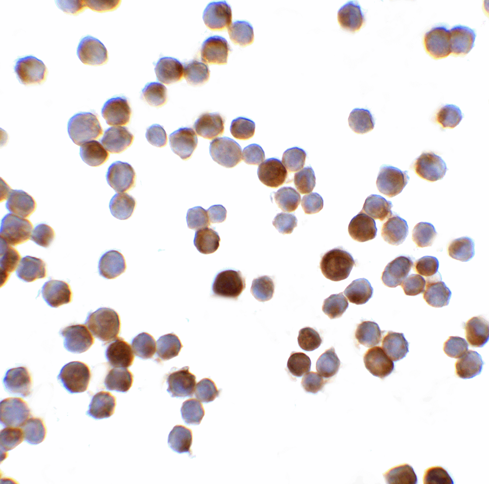 IHC-plus™ Polyclonal Rabbit anti-Human RFX / RFX1 Antibody (IHC, IF, WB)