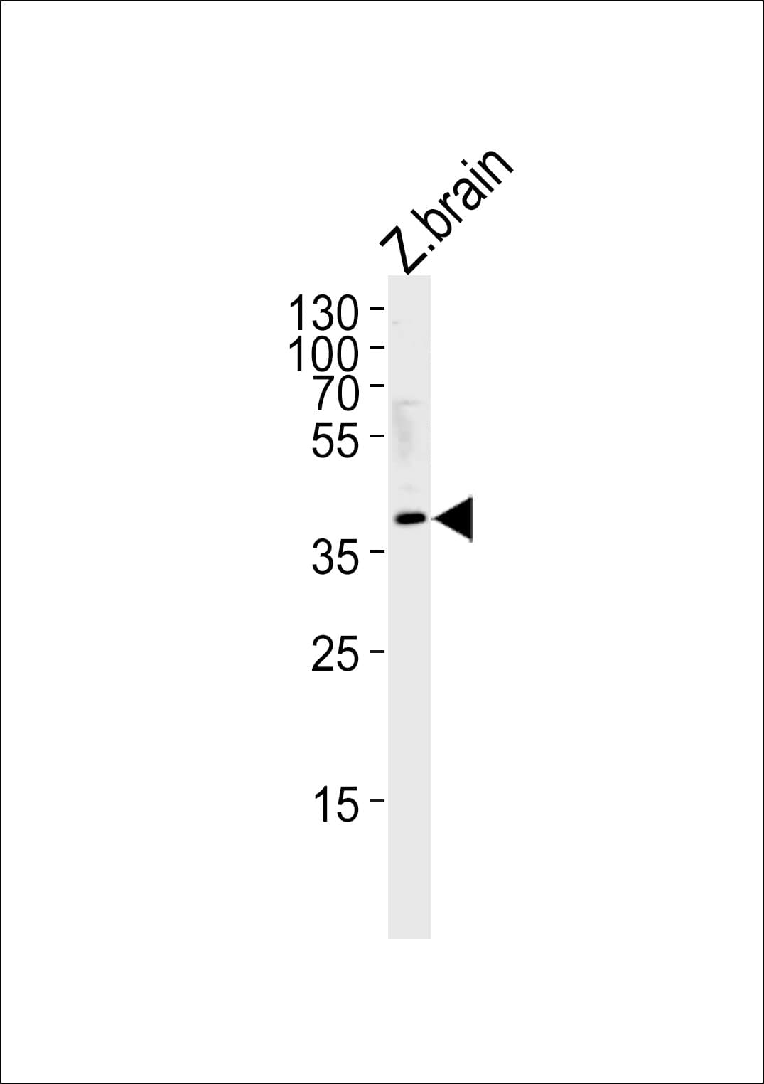 CHF1 / HEY2 Antibody (aa295-322)