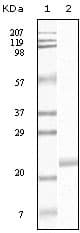 Monoclonal Mouse anti-Human EPHB4 / EPH Receptor B4 Antibody (clone 5B8F7, IHC, WB)