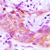 CKLFSF4 / CMTM4 Antibody (Internal)