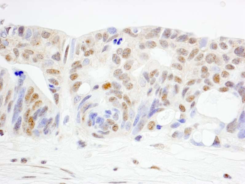 WRNIP1 / WHIP Antibody (aa400-450)
