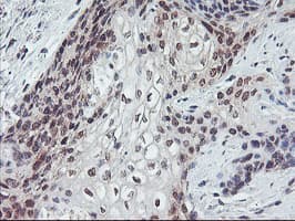 PPP1R15A / GADD34 Antibody (clone OTI3D12)