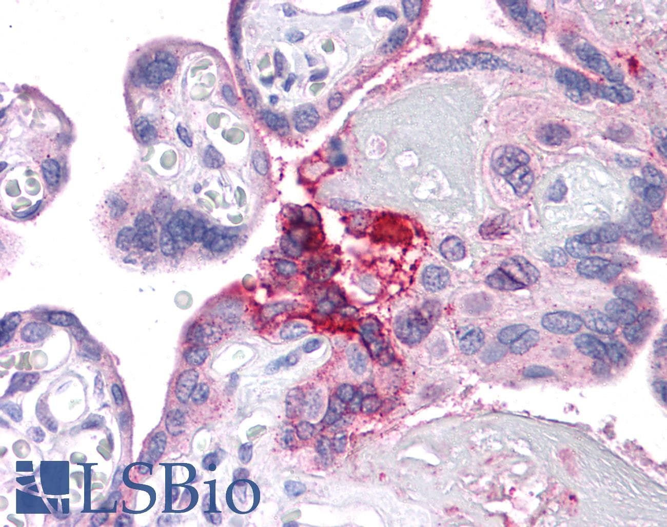 IHC-plus™ Polyclonal Rabbit anti-Human ESX1 Antibody (IHC, IF, WB)