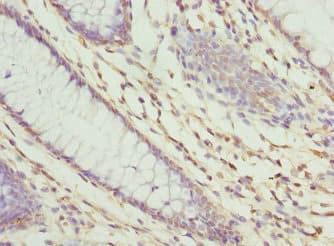 Polyclonal Rabbit anti-Human ZNF324 / ZF5128 Antibody (IHC, WB)