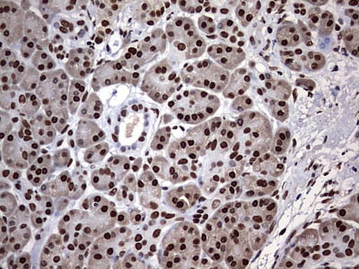 HNRPM / HNRNPM Antibody (aa1-261, clone OTI1E12)