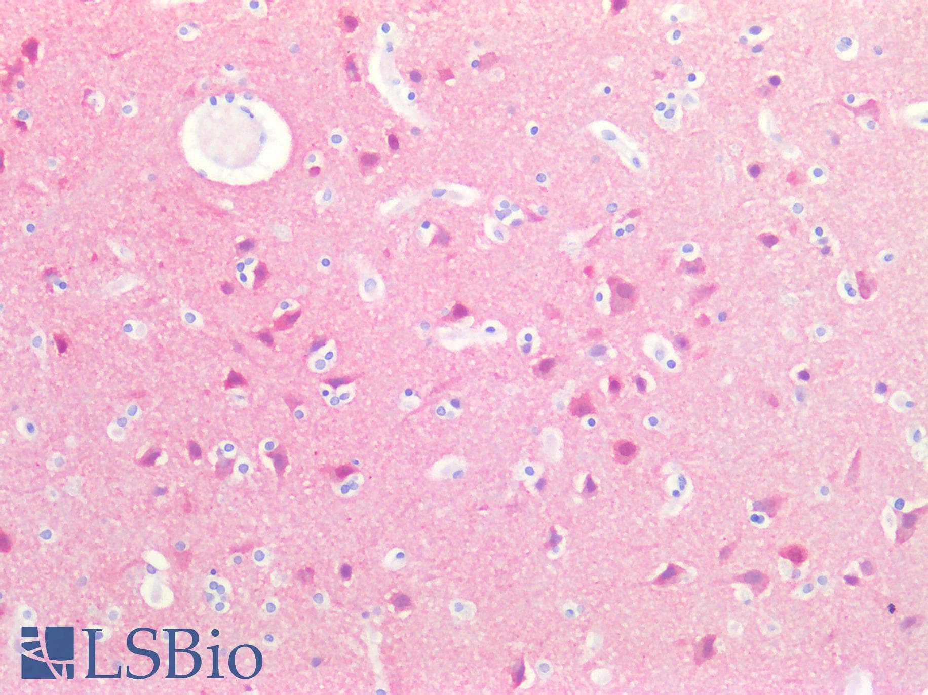 IHC-plus™ Polyclonal Rabbit anti-Human SH3GL2 Antibody (IHC, IF, WB)