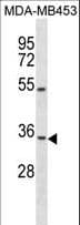 Polyclonal Rabbit anti-Human OSTM1 Antibody (aa292-321, WB)